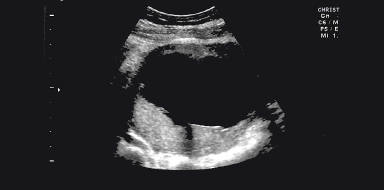 36714-ultrasound-christology