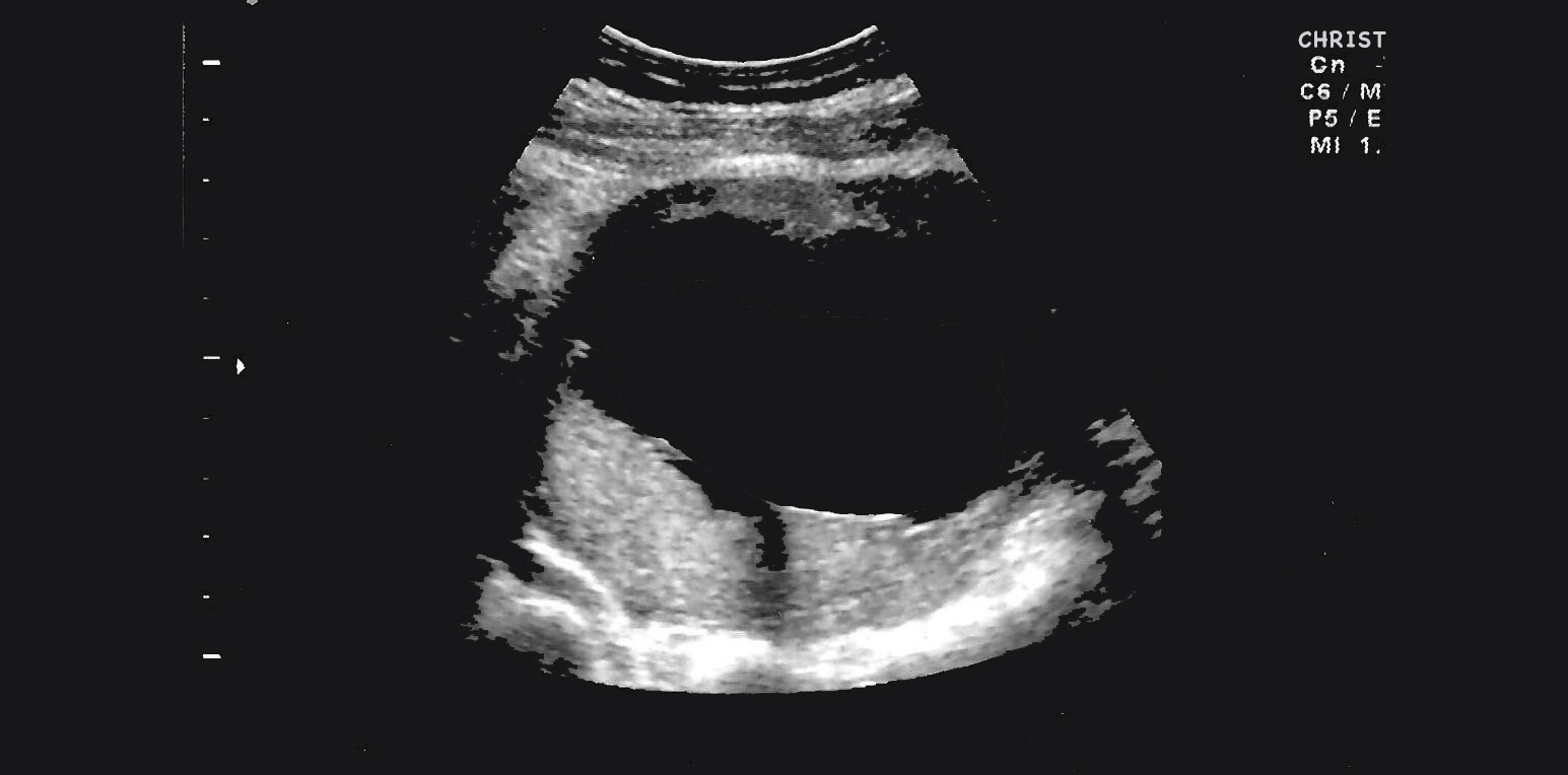 36714-ultrasound-christology